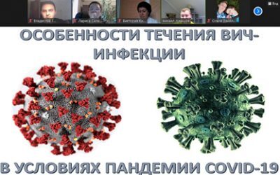 PECULIARITIES OF THE HIV INFECTION COURSE IN CONDITIONS OF THE COVID-19 PANDEMIC